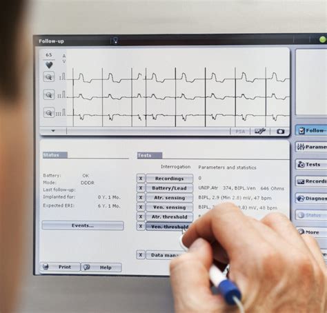 24/7 Ambulatory ECG and CIED Remote Monitoring .